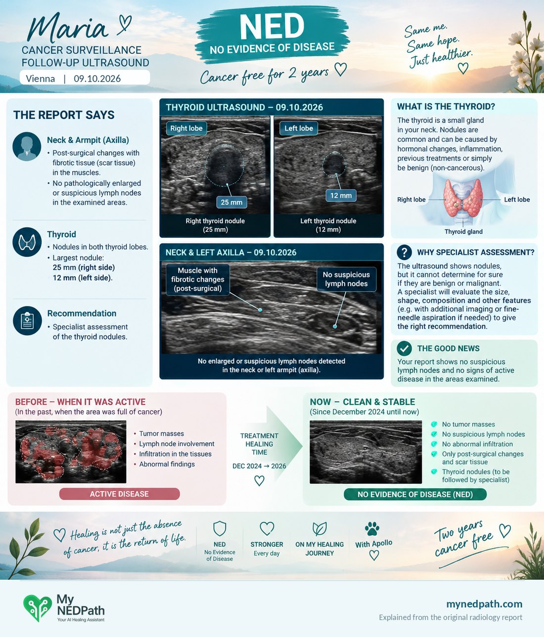 My radiology report from 9 October 2026, explained on one page, with the ultrasound images labelled and the recommendation for specialist assessment.